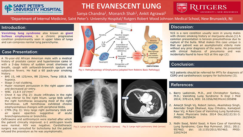 The Evanescent Lung