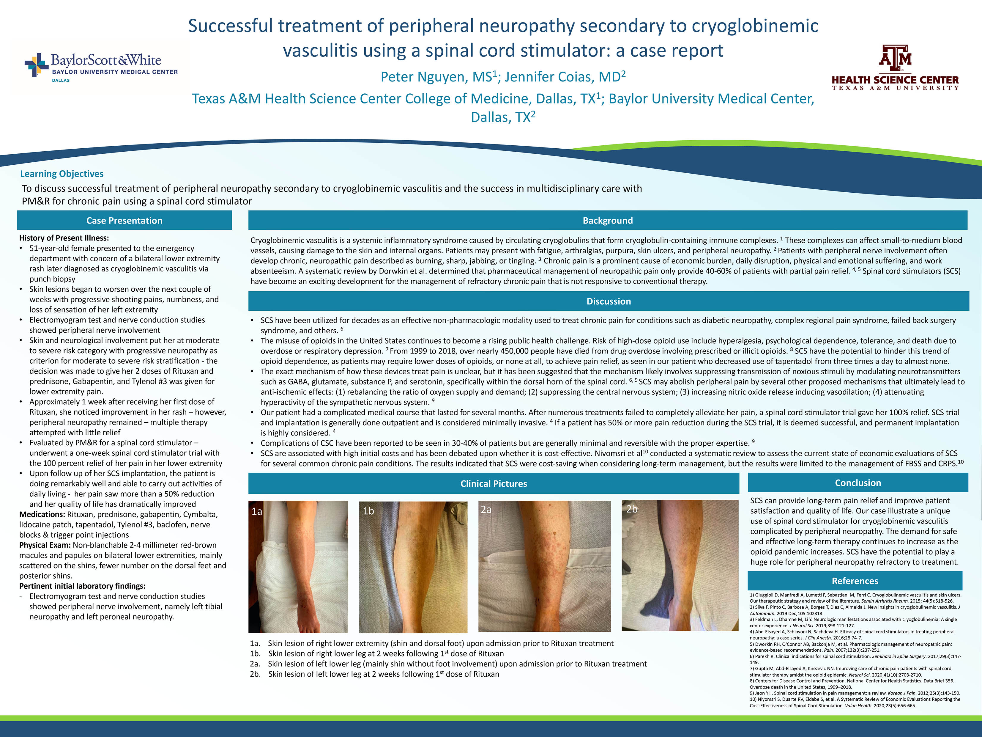 successful-treatment-of-peripheral-neuropathy-secondary-to